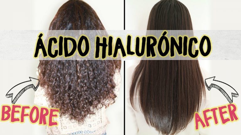Acido hialuronico cabello